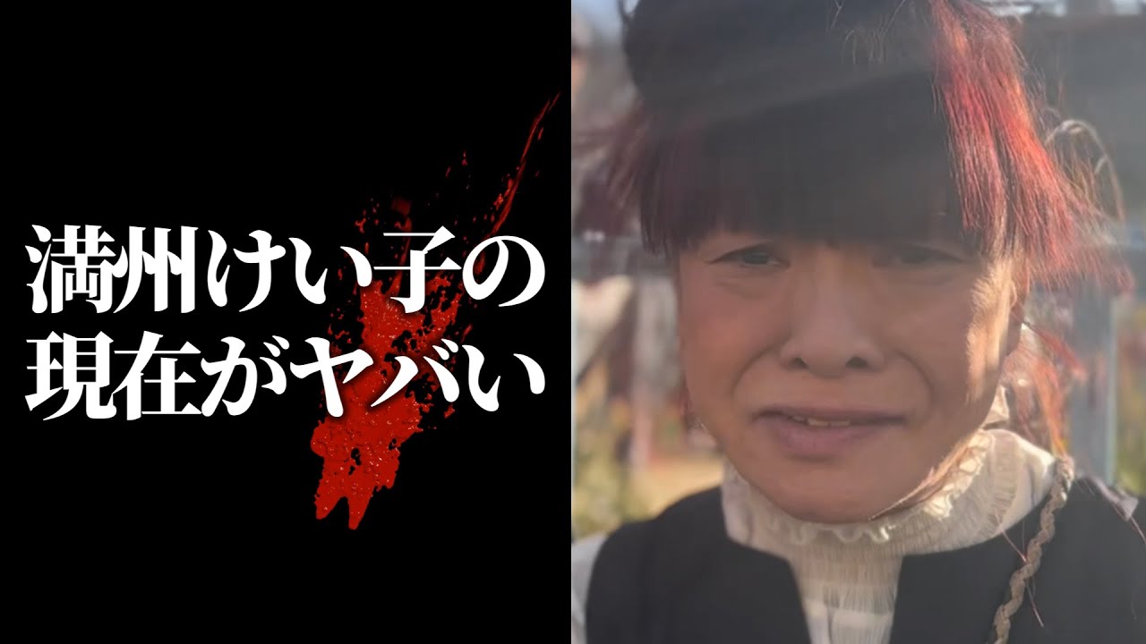 満州けい子（坂田佳子）実は入院していました。