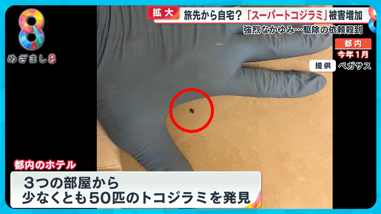 【拡大】旅先から自宅？スーパートコジラミ被害増加 強烈なかゆみで駆除の依頼殺到【めざまし８ニュース】