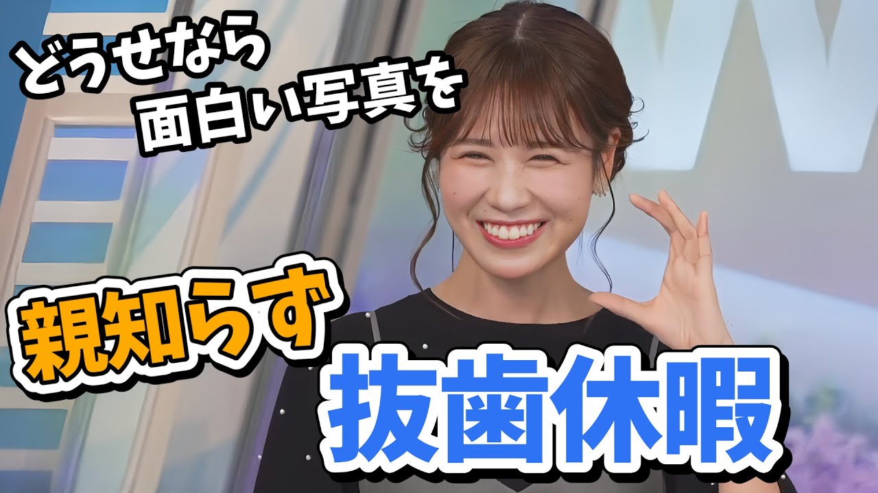 【戸北美月】親知らず抜歯で休暇を取るみーちゃん！どうせならとほっぺが腫れたおもしろ写真を見せたがる【ウェザーニュース切り抜き】
