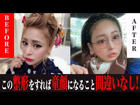 【整形金額3000万円】童顔を目指して東京から名古屋へ整形出張した1日に密着しました。