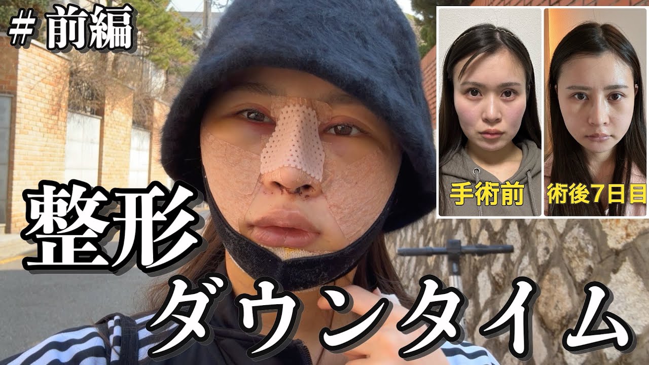 【整形#前編】韓国で人生初大手術を受けてきました！輪郭3点・鼻フル過酷なダウンタイム