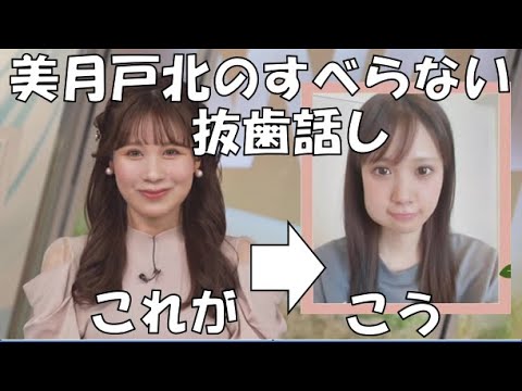 【戸北美月】(🍥´ω｀🍥)っ「みーちゃんのすべらない抜歯のお話し(ニコ生コメ有り)」