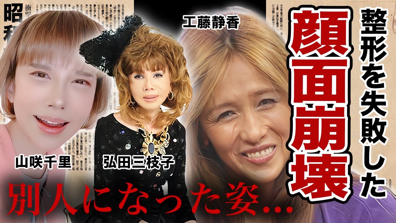 顔面崩壊した女性芸能人・有名人２５選【※多重整形・整形失敗・事故】