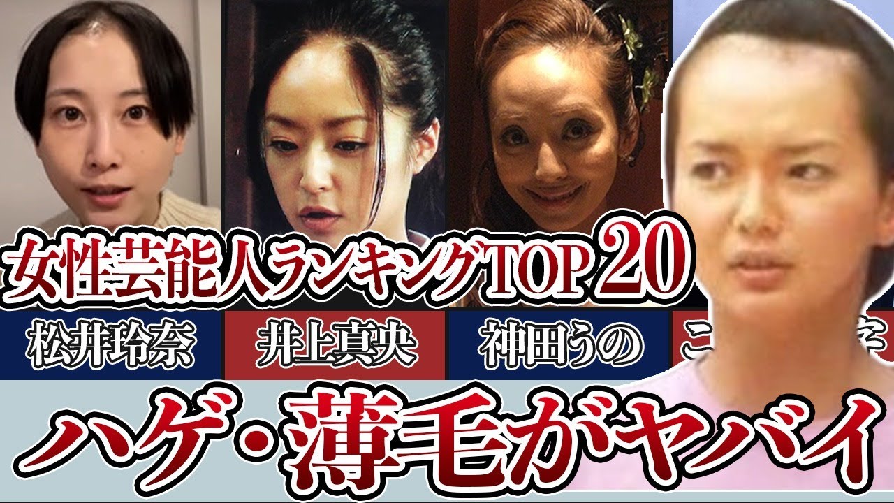 【衝撃ハゲ画像】ハゲが気になる女性芸能人衝撃ランキングTOP２０！