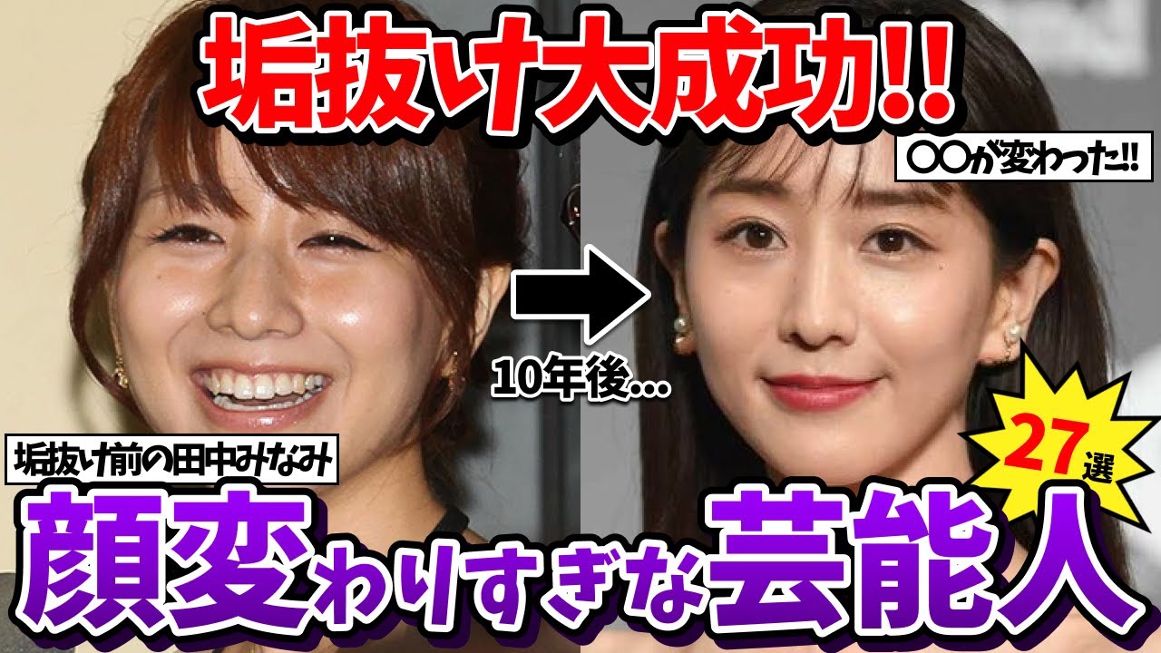 【有益2ch】整形疑惑…？正直顔が変わりすぎだと思う女性芸能人・有名人あげてけww【ガールズちゃんねる】