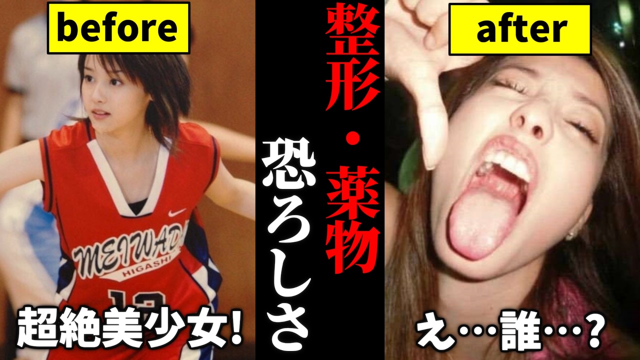 【有益2ch】顔が完全に別人！整形や薬物の恐怖…正直顔が変わりすぎな女性芸能人を発表します【ガルちゃんゆっくり】