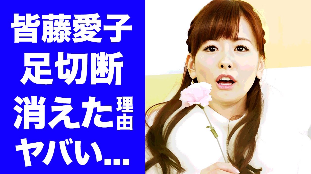 【衝撃】皆藤愛子がテレビから消えた理由...足切断の事故に言葉を失う...『めざましテレビ』でも活躍した女子アナがたった一言でビンタまでされた仕打ちに驚きを隠せない...