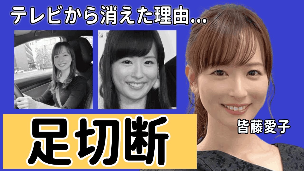 皆藤愛子がテレビから消えた本当の理由...足切断の事故に言葉を失う...『めざましテレビ』でも活躍した女子アナがたった一言でビンタまでされた仕打ちに驚きを隠せない...