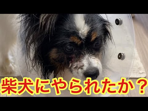 【柴犬飼い主54歳】凶暴犬に噛まれたか？