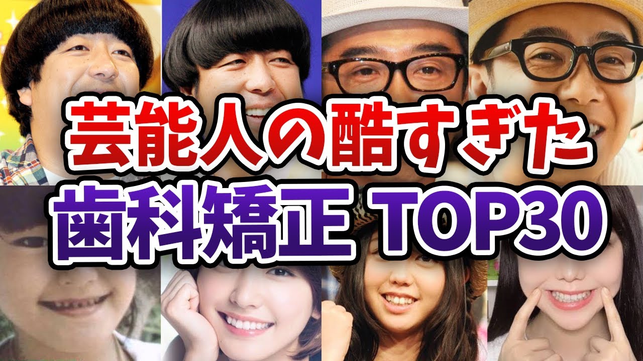 【閲覧注意】歯並び酷すぎ！芸能人の歯科矯正 衝撃ランキングTOP30【ガルちゃんまとめ】