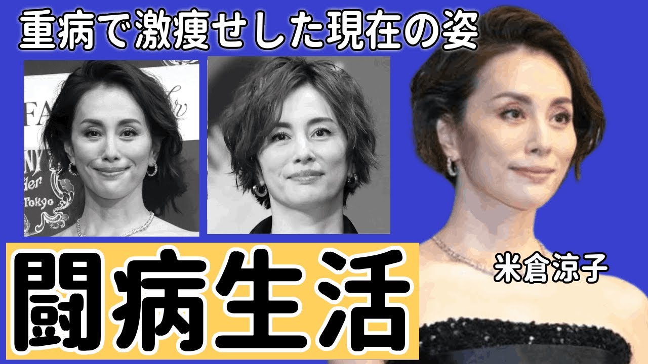 米倉涼子の重病で激痩せした現在の姿がヤバすぎる…「ドクターX」で知られる女優の闘病生活の真実に言葉を失う…体を回復ための努力に…