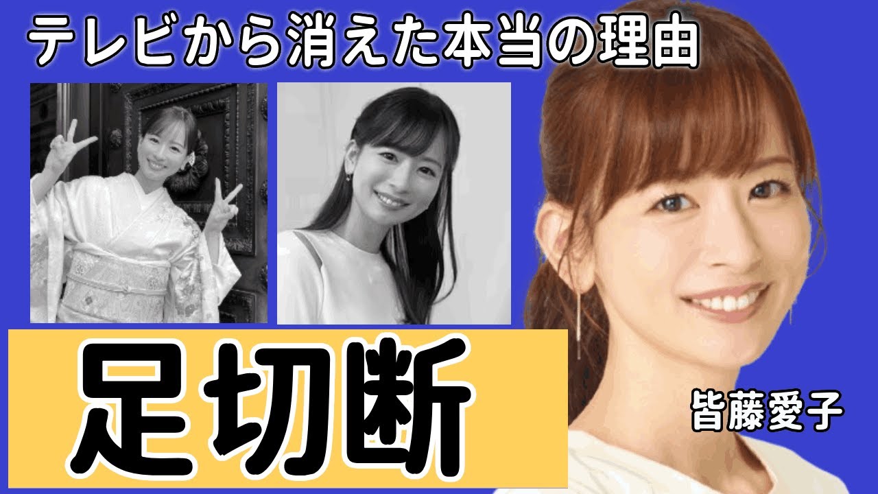 皆藤愛子がテレビから消えた本当の理由...足切断の事故の真相に一同驚愕...「めざましテレビ」で有名な女子アナがたった一言でビンタまでされた仕打ちに言葉を失う...