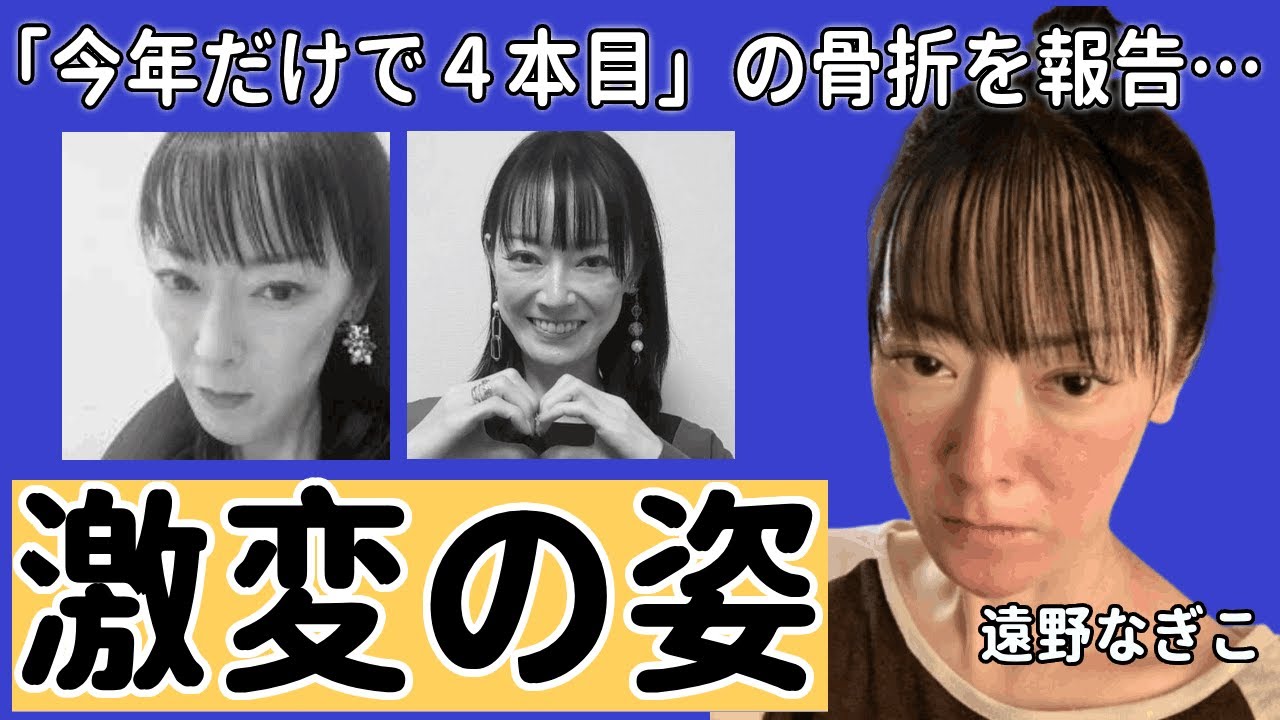 朝ドラヒロイン女優遠野なぎこが「今年だけで４本目」の骨折を報告…激変した現在の姿や語る摂食障害の現実...