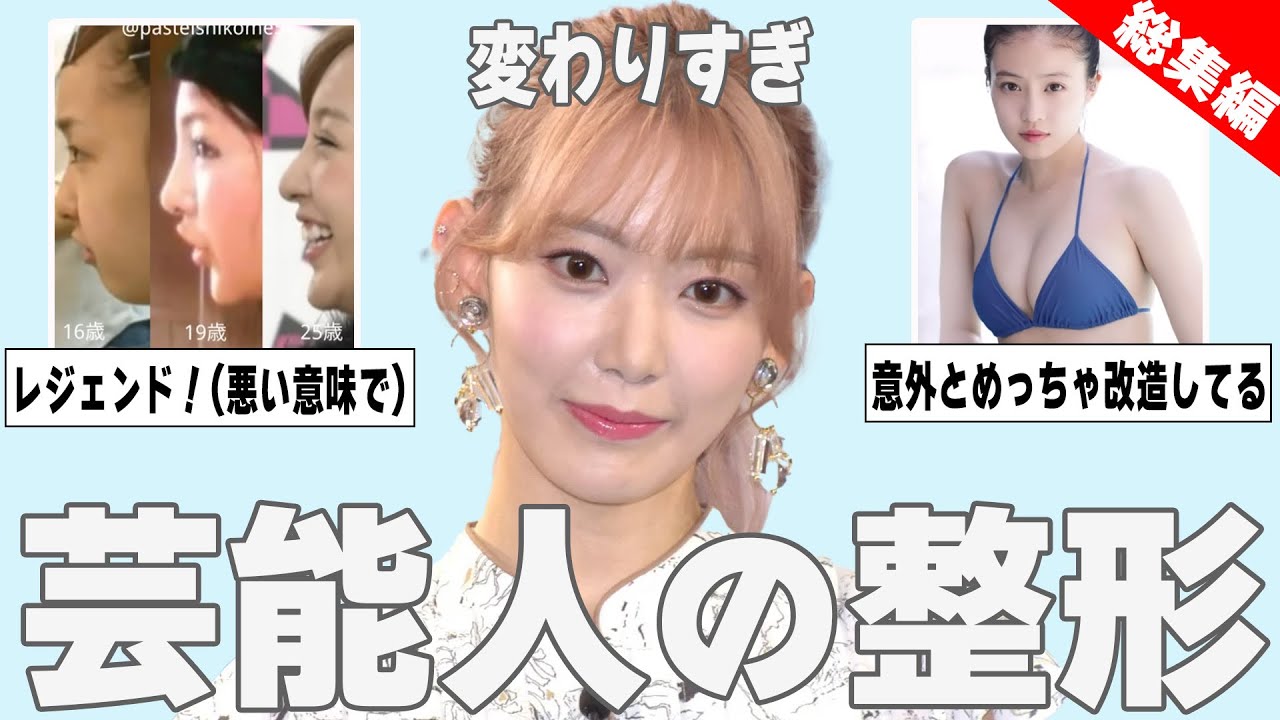 【ガルちゃん芸能】整形だよね？と思う芸能人を紹介【総集編】