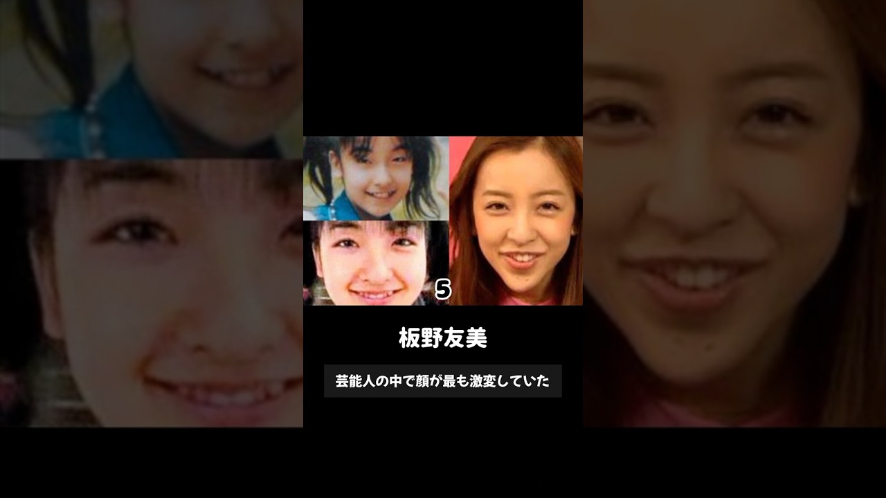 整形してブスから美人に変わった芸能人15名