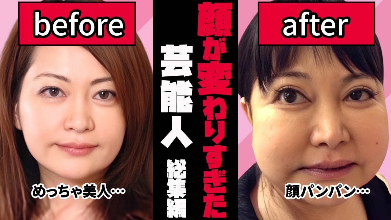 【ガルちゃん芸能】え…別人だよね？整形？顔が変わった芸能人 【総集編】【有益2ch】