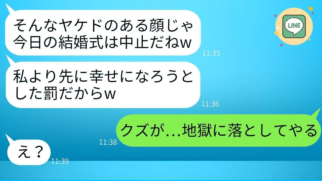 結婚式の前日に私に硫酸をかけて大火傷を負わせた幼馴染「これで式はキャンセルだねw」→やりたい放題の最低な女に罰を与える結果となったwww