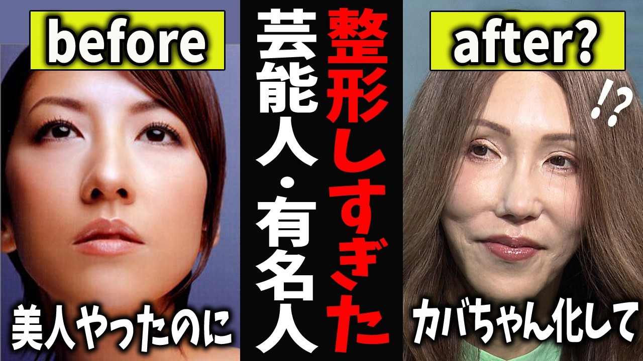 【ガルちゃん芸能】マジで整形やり過ぎてる！顔が変わってしまった芸能人【有益2ch】