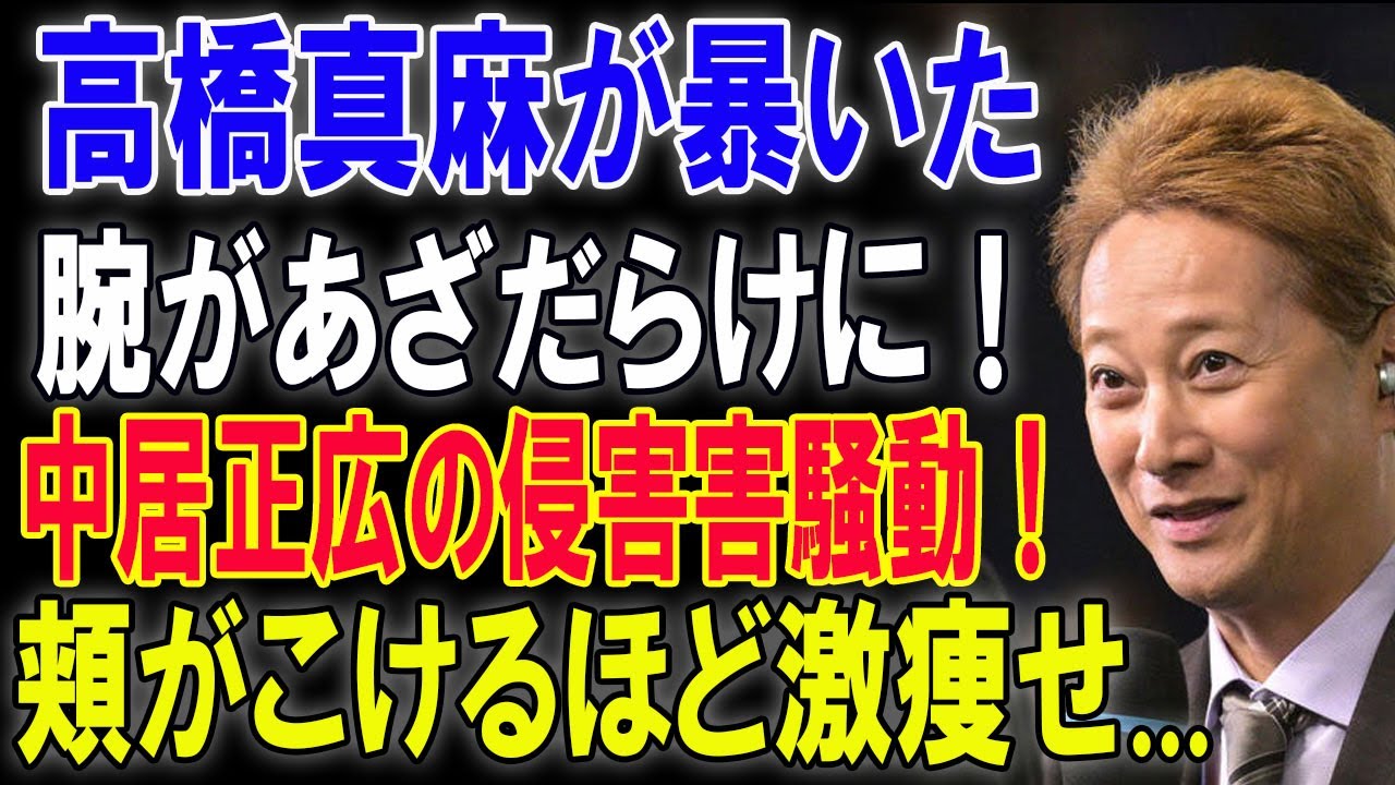 高橋真麻が暴いた腕があざだらけに！中居正広の侵害害騒動！頬がこけるほど激痩せ...正直全てが胸糞悪いです。
