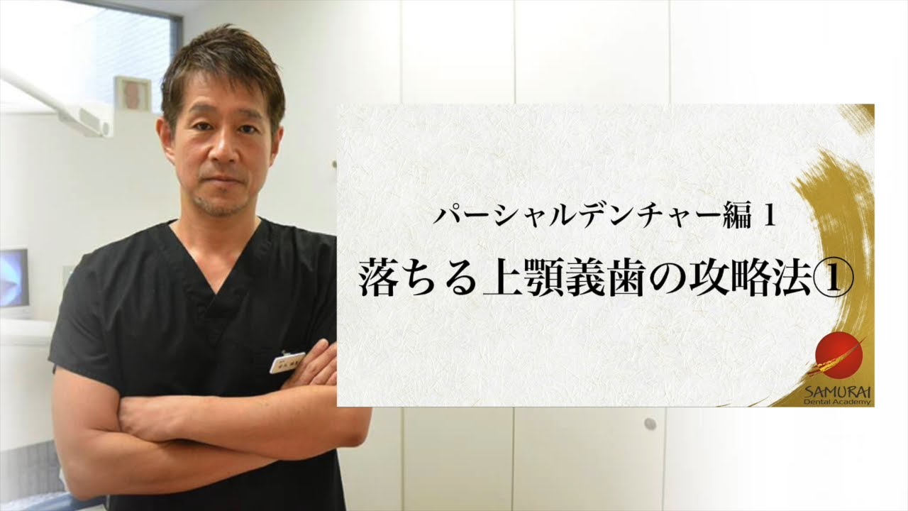 #56_パーシャルデンチャー編１　落ちる上顎義歯の攻略法①｜SDA