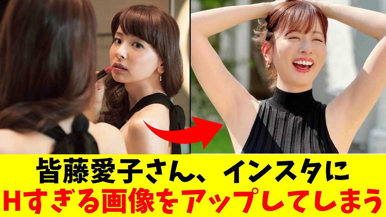皆藤愛子さん、どうしたの？【フジテレビ・女子アナ】