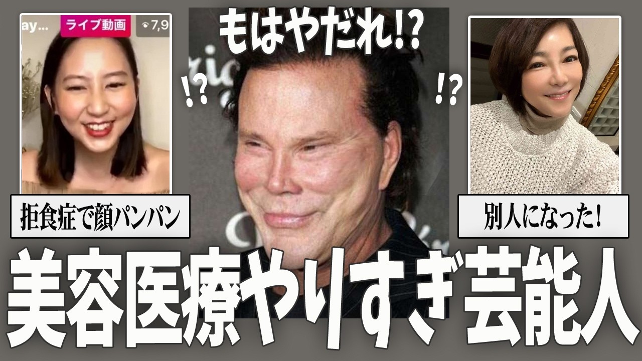 【ガルちゃん芸能】顔が不自然...美容医療やりすぎだと思う芸能人【有益2ch】