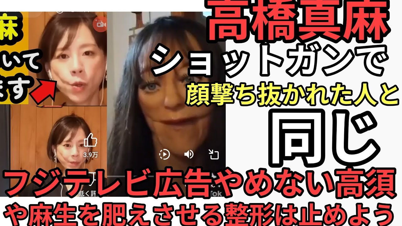 高橋真麻　ショットガンで撃たれた女性と同じようになる。整形は後悔する　フジテレビにCM出す高須やきむぽくてを超え太らせてはいけない
