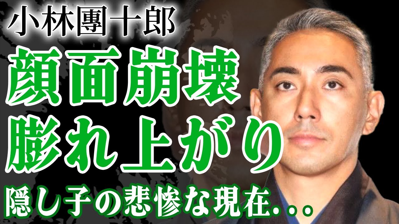 市川團十郎の顔が膨れ上がって別人に...難病に苦しめられる現在に驚愕！『歌舞伎界のプリンス』と言われる役者の隠し子の現在...小林麻耶による呪いがいまだに続いている真相に言葉を失う！