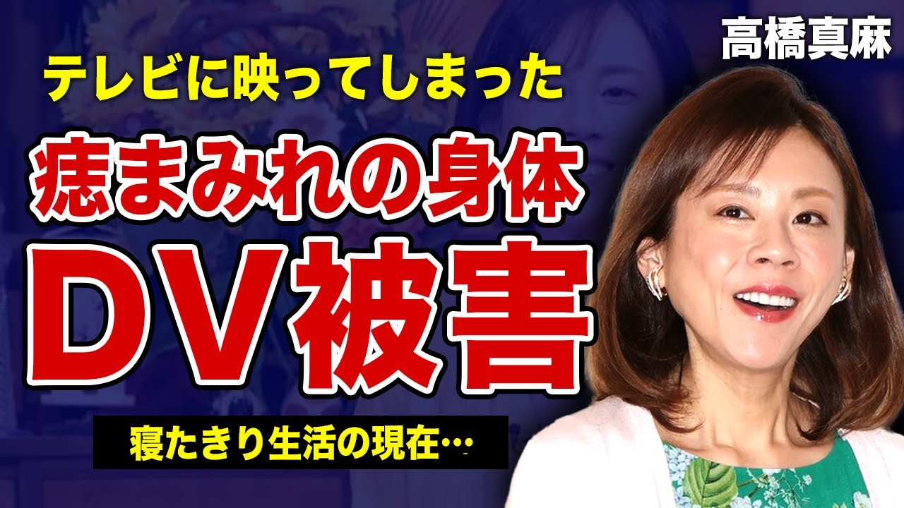 高橋真麻のアザがテレビに映った全貌…夫から受け続けた壮絶なDVの傷跡に言葉を失う…！重病で激痩せ・寝たきり生活の現在に一同驚愕！二世帯同居を解消した真相…父・高橋英樹が施設に入居した裏側がやばい！
