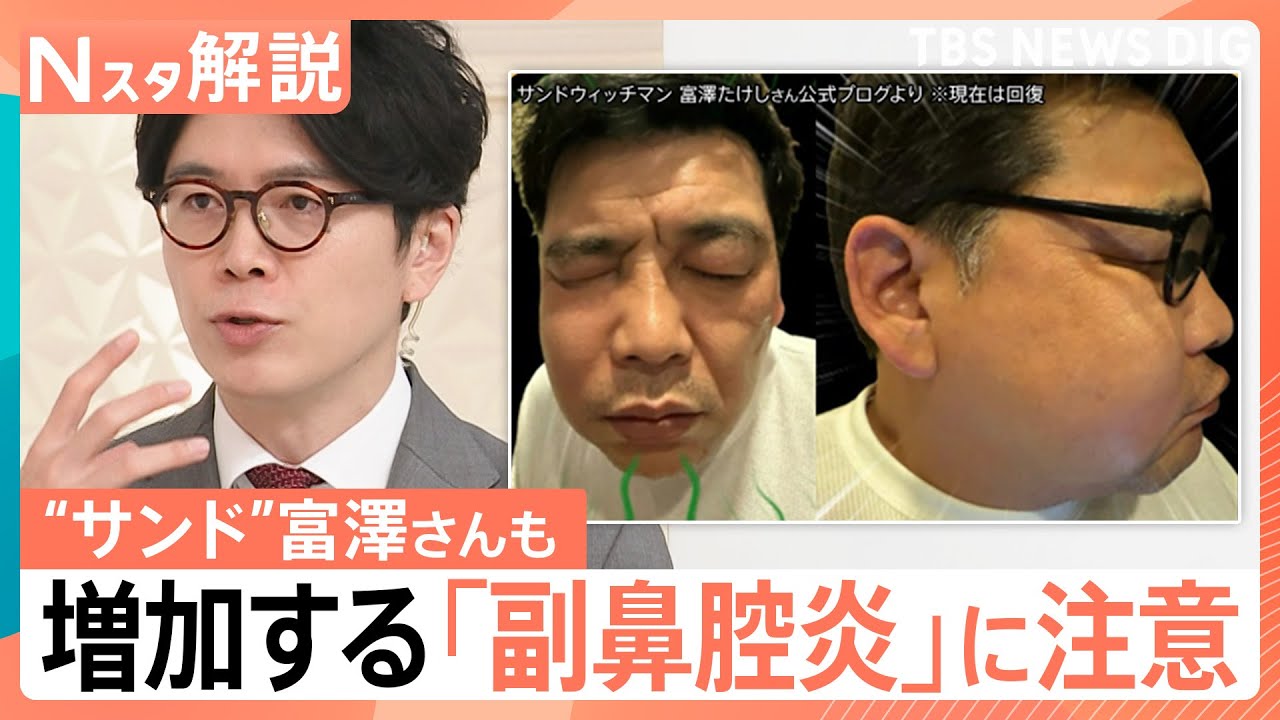 “顔の腫れ”に“視力低下”のおそれも…増加する「副鼻腔炎」　花粉のピークが過ぎた季節に注意したい“鼻トラブル”【Nスタ解説】｜TBS NEWS DIG