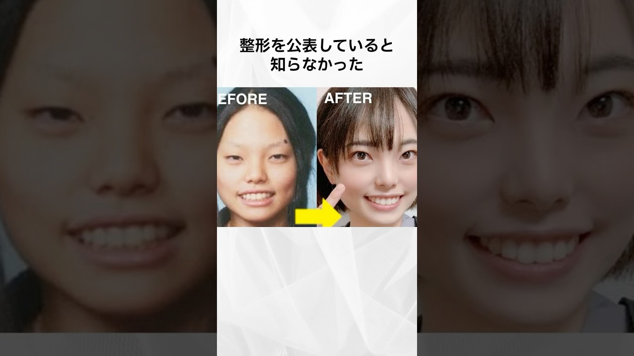 整形を公表していると知らなかった女性芸能人まとめ#shorts #芸能人 #整形
