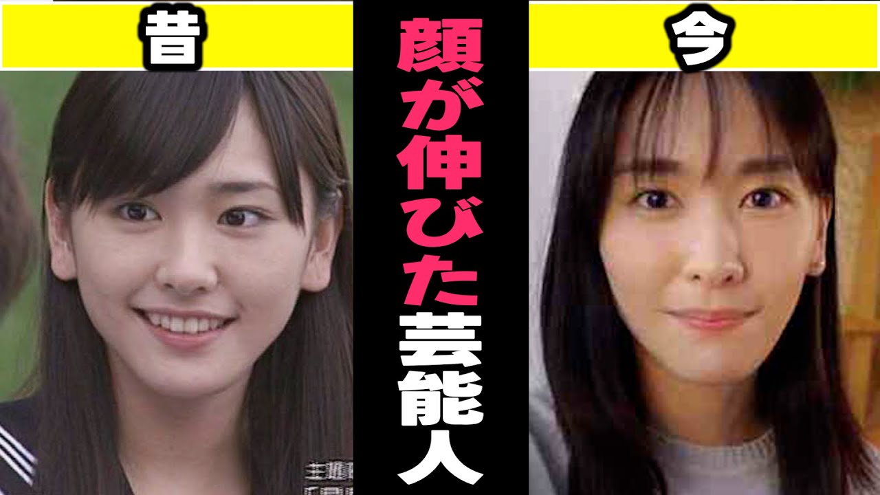 【ガルちゃん芸能】顔が伸びたと思う芸能人まとめ【有益】