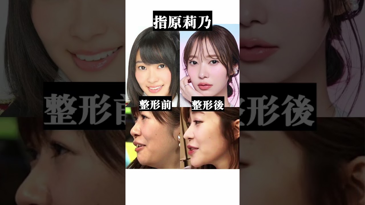 整形バレバレな元AKBメンバー#整形 #akb48 #二重整形