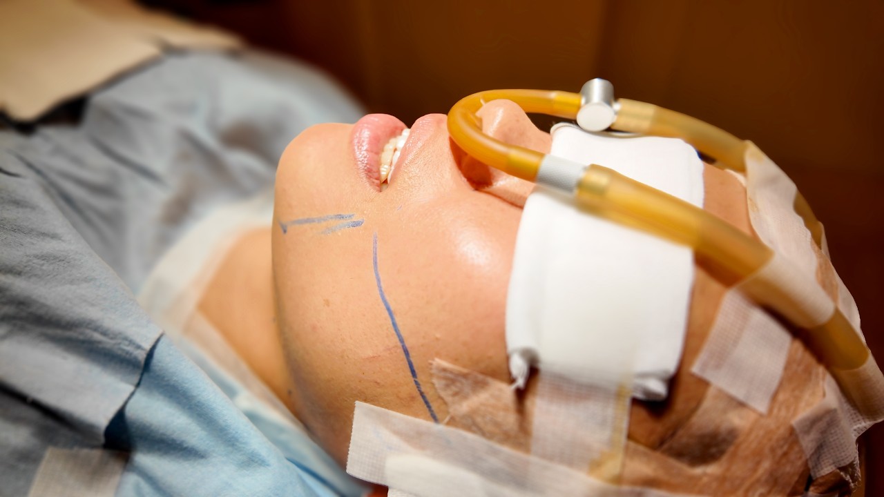 【告白】実は整形してました。【ロシアン佐藤】【RussianSato】