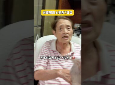 【その後】腕の様子はどうなった…？#中西家の日常 #日常 #皮膚炎#おばあちゃん#YouTube#shorts