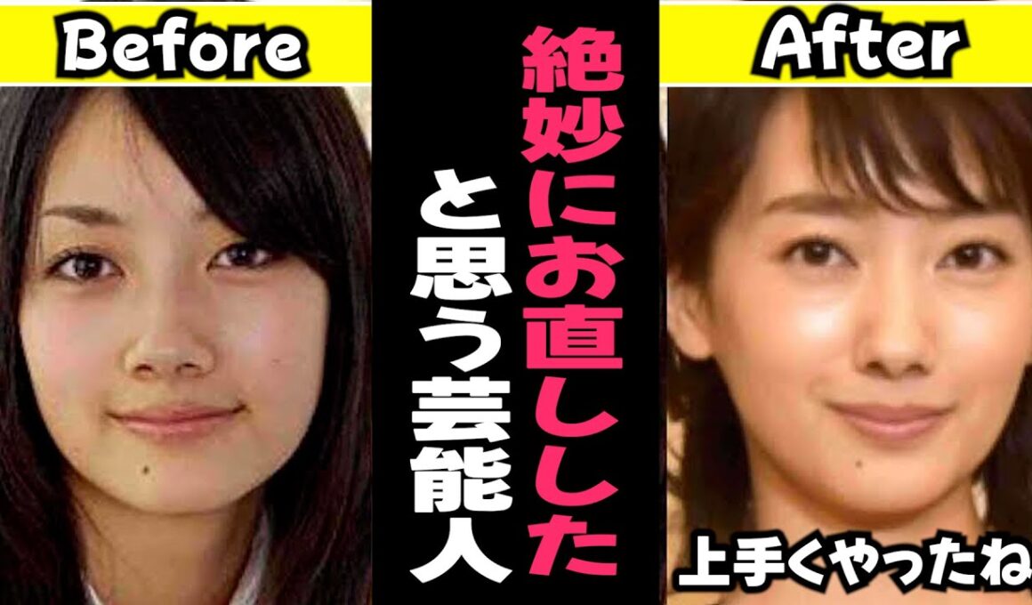 【ガルちゃん芸能】絶妙にお直ししたと思う芸能人まとめ【有益】