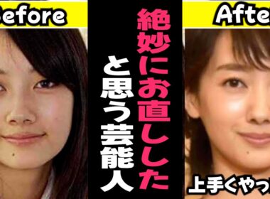 【ガルちゃん芸能】絶妙にお直ししたと思う芸能人まとめ【有益】