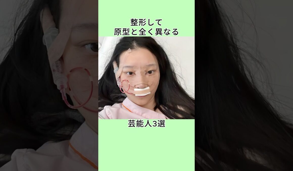 整形して原型と全く異なる芸能人3選  #shorts