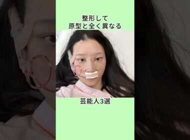 整形して原型と全く異なる芸能人3選  #shorts