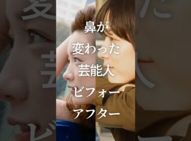 鼻が変わった芸能人ビフォーアフター　#ガルちゃん #芸能人 #鼻整形