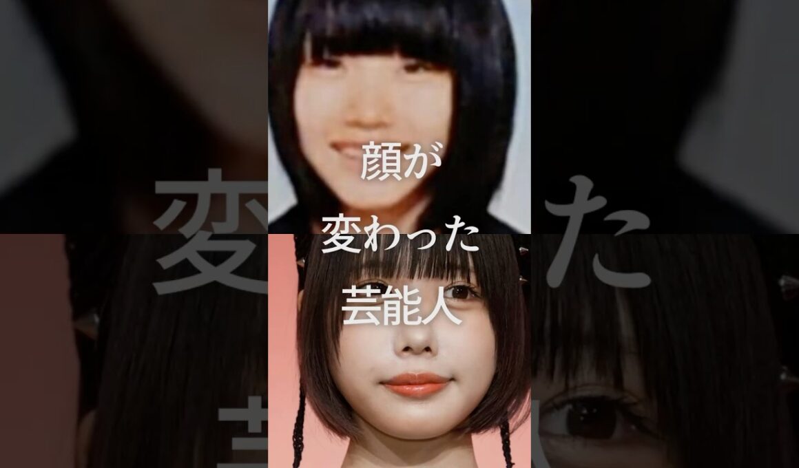 顔が変わった芸能人Part2　#ガルちゃん #芸能人 #整形