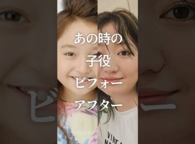 ㊗️100万再生！あの時の子役ビフォーアフター　#ガルちゃん #芸能人 #子役