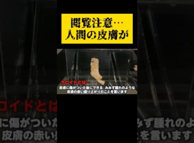 【これが原爆…】何を思いますか？