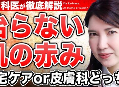 【赤ら顔】悪化する危険なスキンケア。皮膚科医友利新が病院に行くべき酒さと、自宅でできるスキンケアを話します。