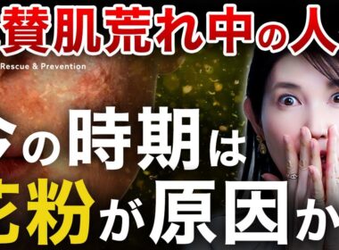 今肌荒れ中の人集合📣この時期の肌のヒリつき・赤みの放置は花粉を疑って！皮膚科医友利新がおすすめのアイテム