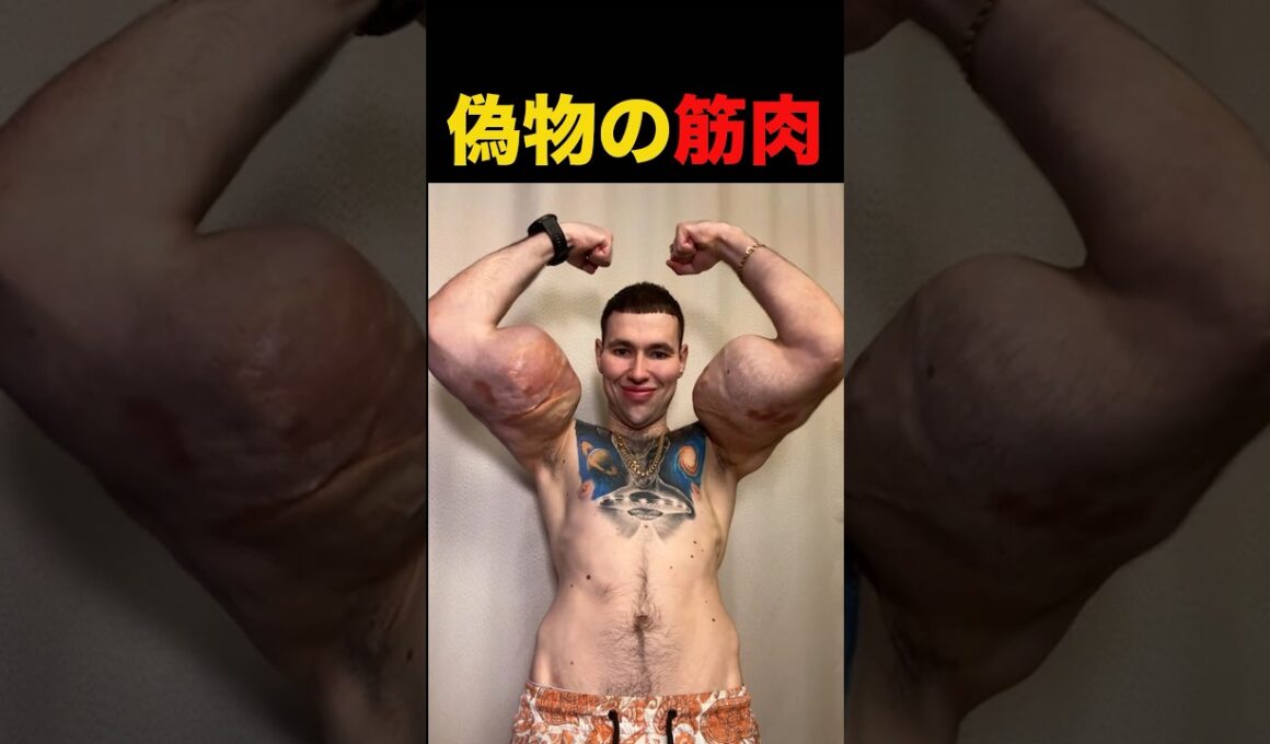 腕にワセリンを注射して詰んだ！#shorts