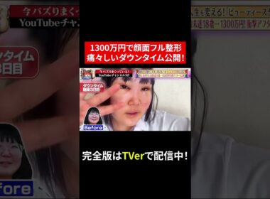 【じっくり聞いタロウ】1300万円でフル整形！痛々しいダウンタイム…