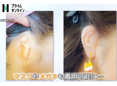 外見に「自信」取り戻し、憧れの結婚指輪写真も…「エピテーゼ」制作現場を山﨑夕貴キャスターが取材（2026年04月03日）