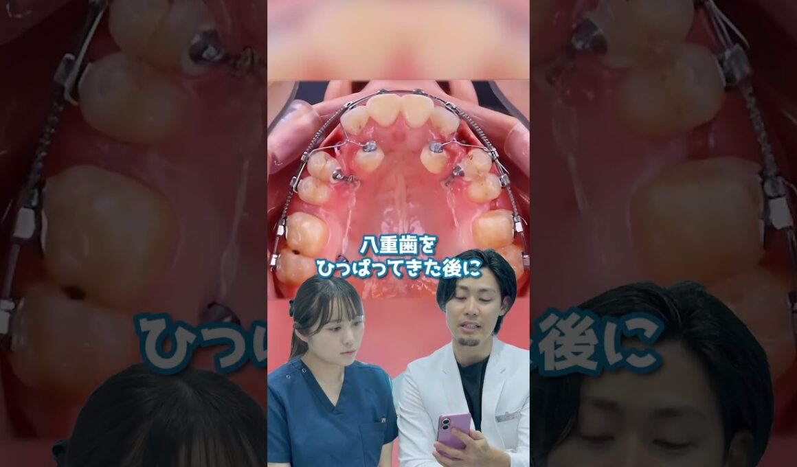 歯並び綺麗にしたいですか？