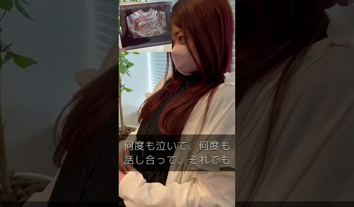 無事に移植が終わりました